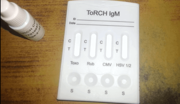 Купить справку анализ крови на TORCH-комплекс